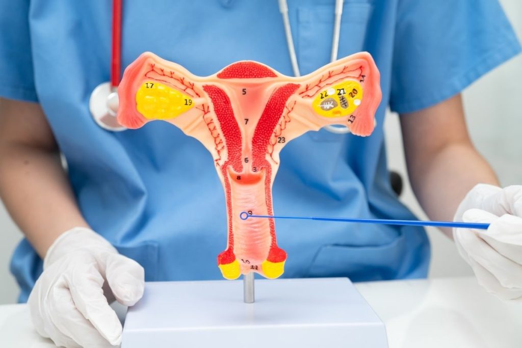 Rahim İçi Yapışıklık